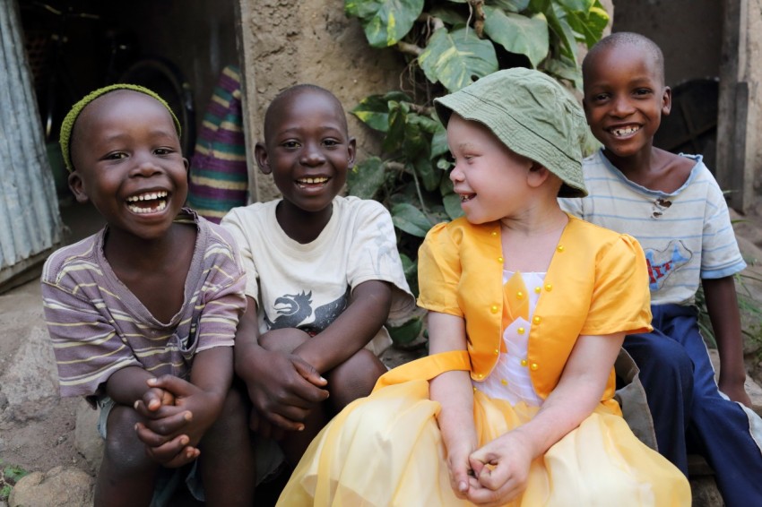 Unidentified albino child and boys in Ukerewe, Tanzania